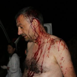 В Овидиополе напали на главного редактора местной «Правды»