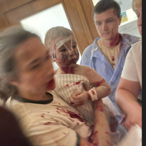 Ракетний обстріл Києва: окупанти вдарили по головній дитячій лікарні країни