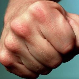 В Придунавье 18-летний парень жестоко избил женщину пнем: пострадавшая лишилась части скальпа