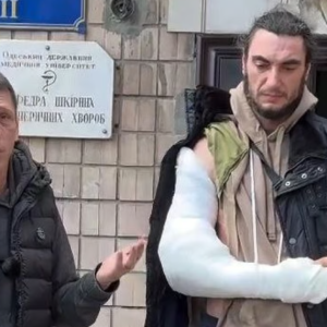 В Одесі розслідують травмування ветерана під час конфлікту з людьми у формі