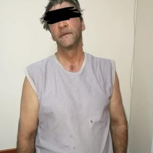 В Одессе задержали мужчину, который облил ребенка кислотой