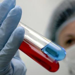 Каких штаммов гриппа измаильчанам стоит опасаться в нынешнем году