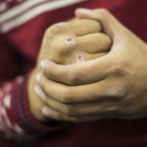 В Килии мужчина забил знакомого до смерти табуреткой