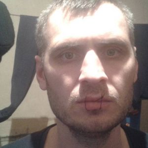 В Измаильском СИЗО в знак протеста арестант зашил себе рот и выслал фото журналистам (ФОТО)